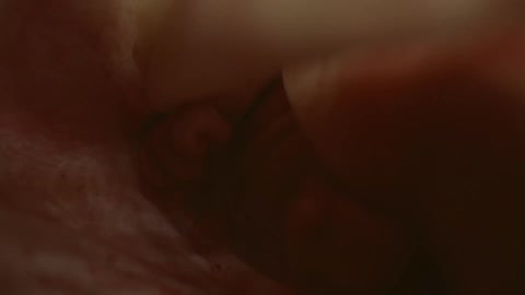 A baby inside the birth canal