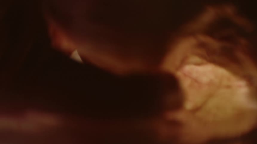 A fetus in utero