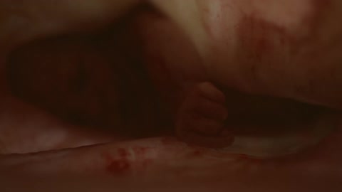 Unborn babys face and hands in the womb