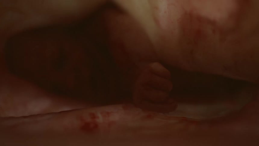 Unborn babys face and hands in the womb