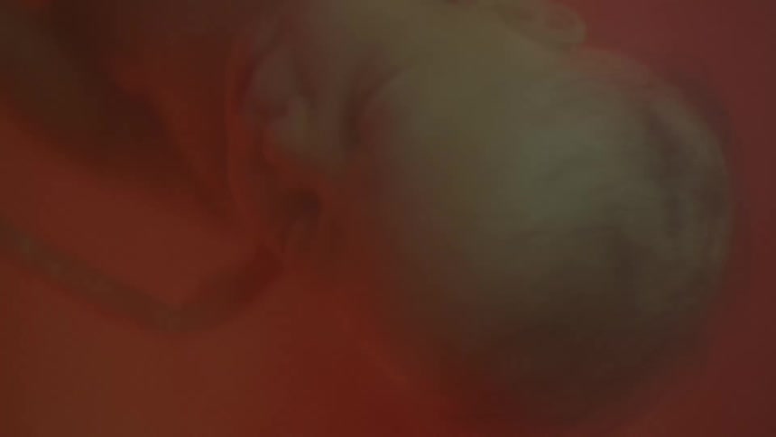 A fetus floats upside down within a uterus while tangled in its umbilical cord
