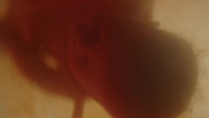 A fetus floating in amniotic fluid