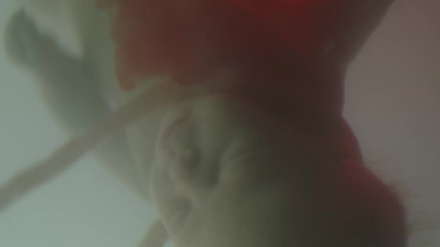 A fetus floats upside down within a uterus as blood diffuses through the amniotic fluid