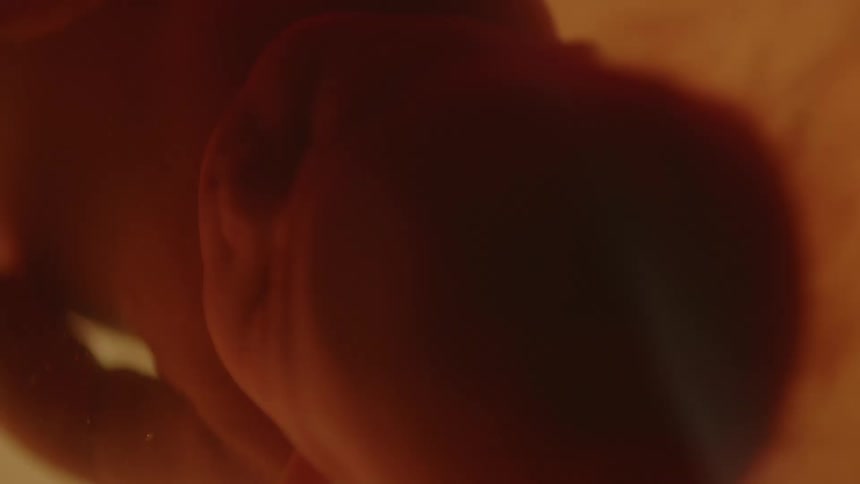 A fetus floating in utero