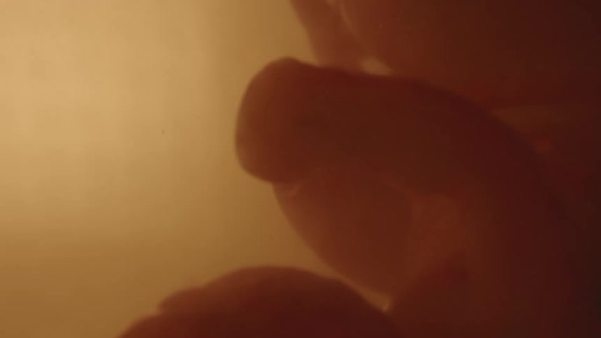 A fetus floats upside down with a uterus full of amniotic fluid