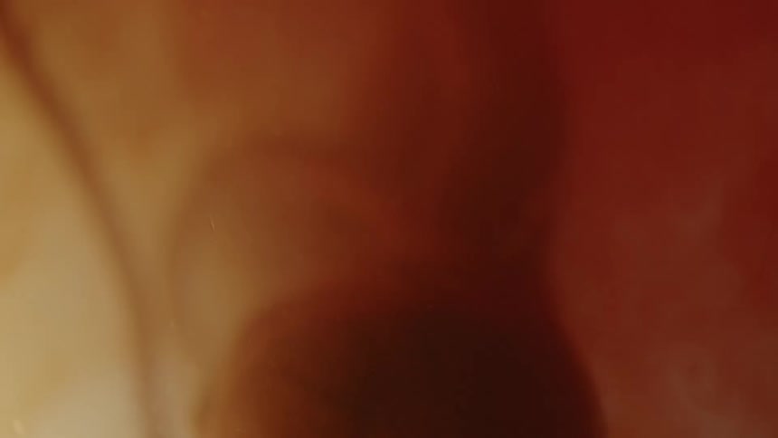 Unborn baby with the cord wrapping around the babys neck in the womb