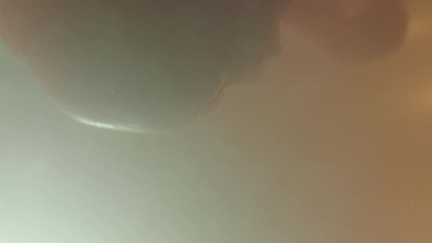 Unborn babys cord and head in the womb