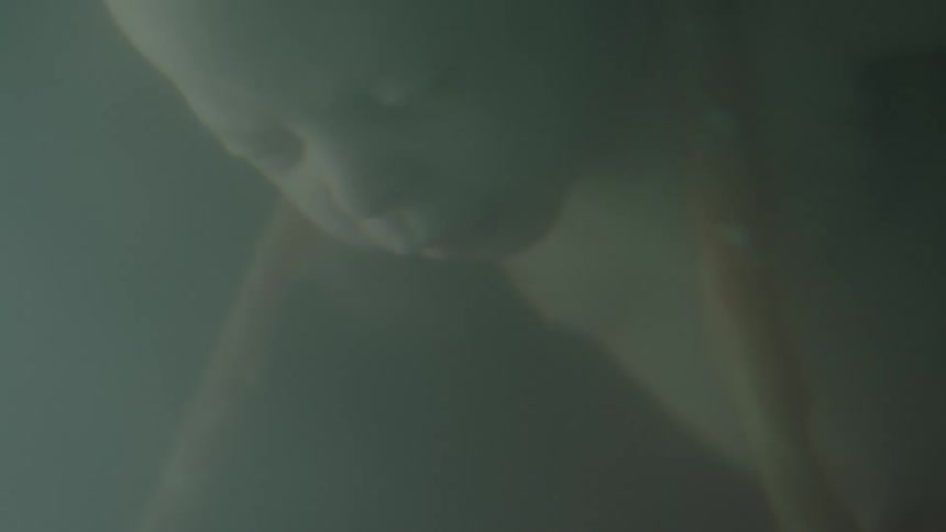 An unborn baby with umbilical cord wrapped around his head floats in fluid