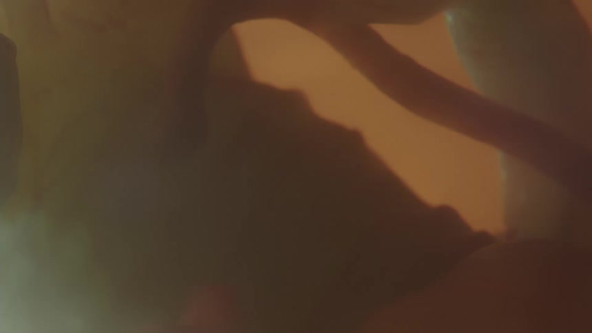 A fetus attached to an umbilical cord in the womb
