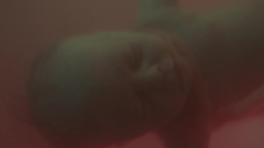 Entanglement of the cord wrapping around the babys neck in mothers womb