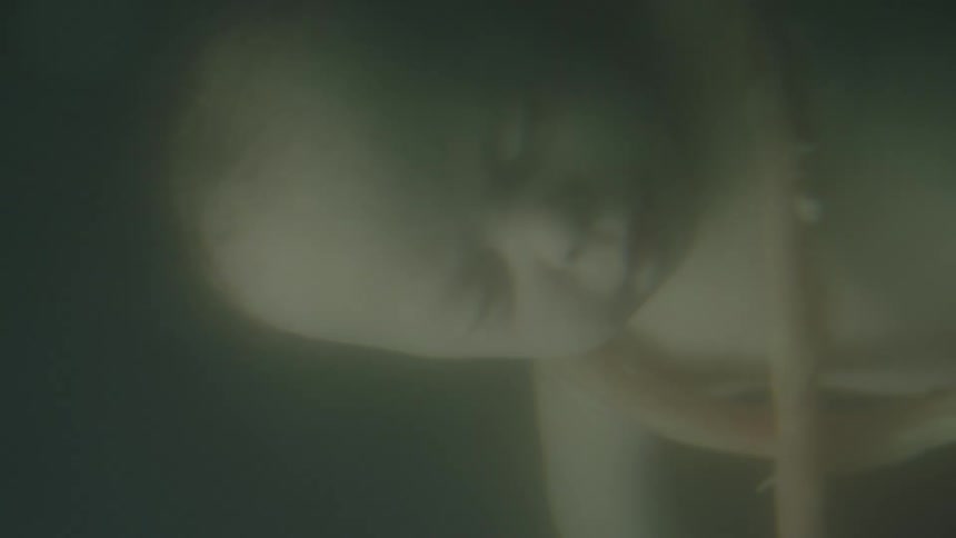 The umbilical cord wraps around the body and neck of an unborn baby floating and turning in fluid