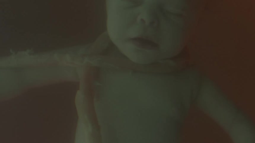 Baby with umbilical cord wrapped around the neck floats in cloudy fluid