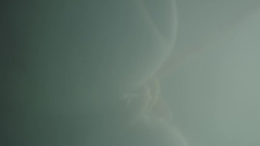 A baby floating in amniotic fluid with umbilical cord visible