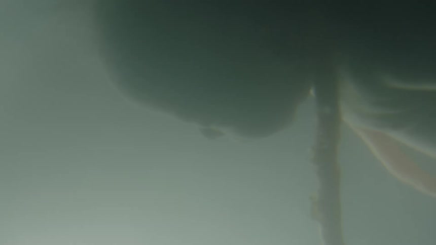 Baby and umbilical cord connecting the baby to its mother in mothers womb