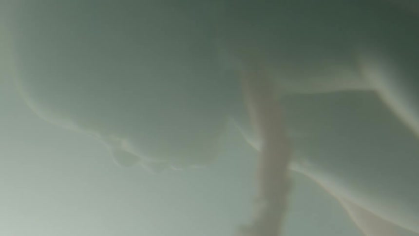 A fetus floating in utero