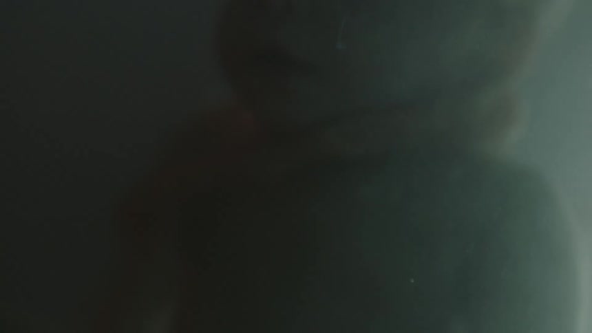 A fetus in a womb with the umbilical cord wrapped around its neck