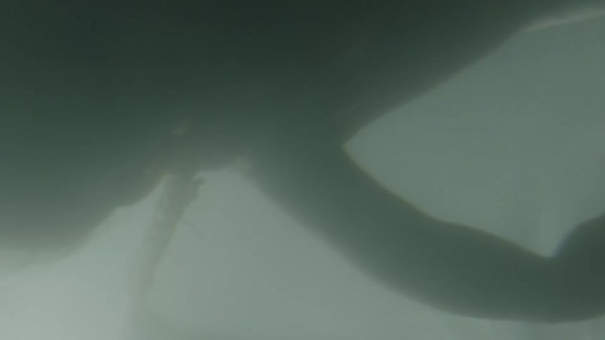 An unborn baby floats with umbilical cord attached