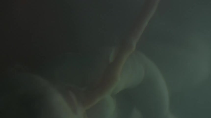 A fetus attached to an umbilical cord floats in a womb