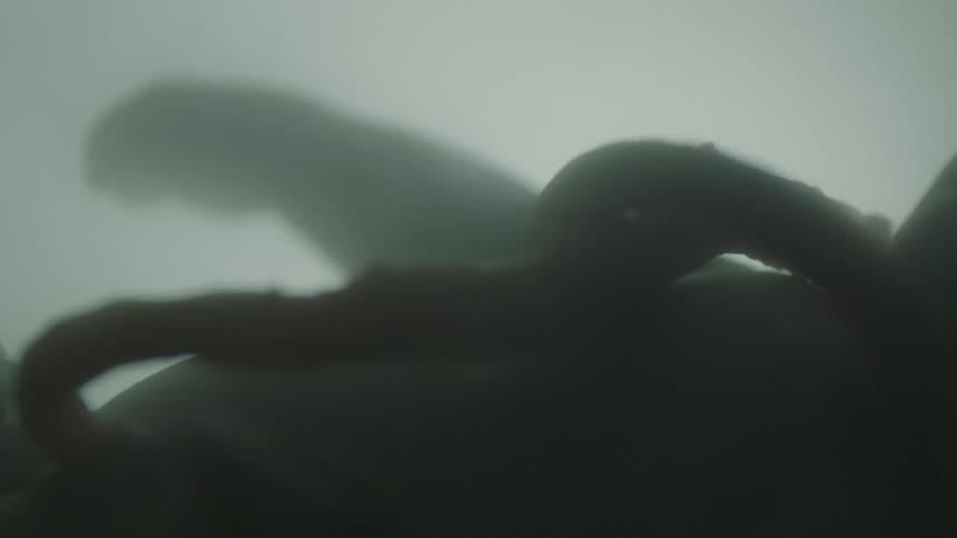A fetus floating in utero