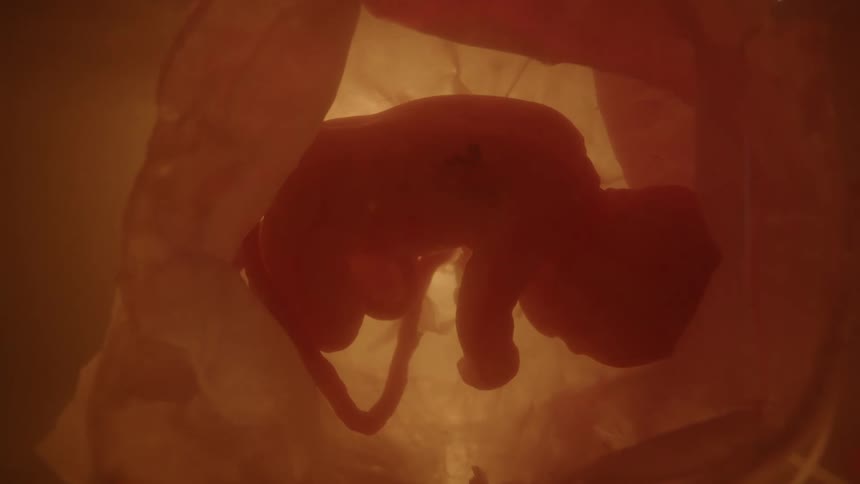 Developing fetus floating in amniotic fluid in utero