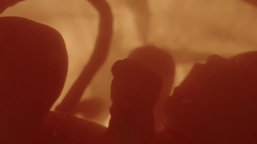 The silhouette of an unborn child with umbilical cord floating in the womb