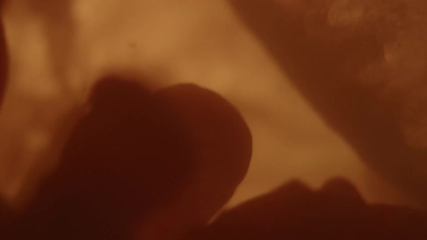 Unborn babys hands and face in the womb