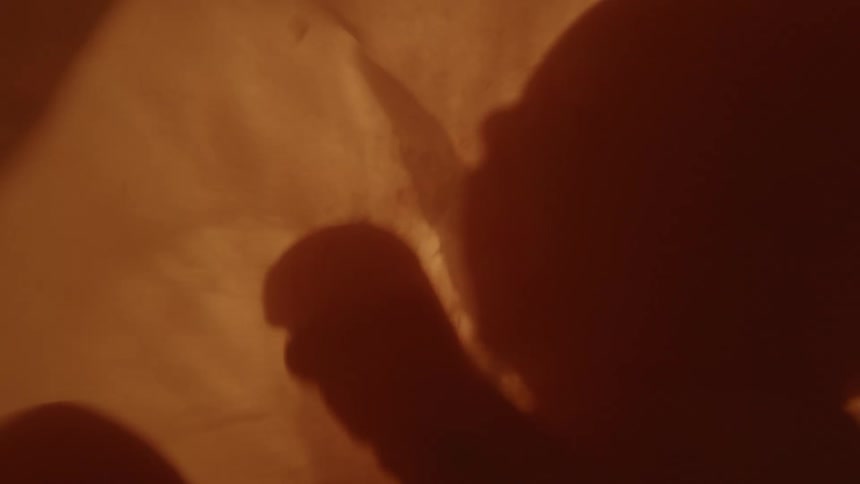 Unborn babys face and hands are silhouetted in the womb
