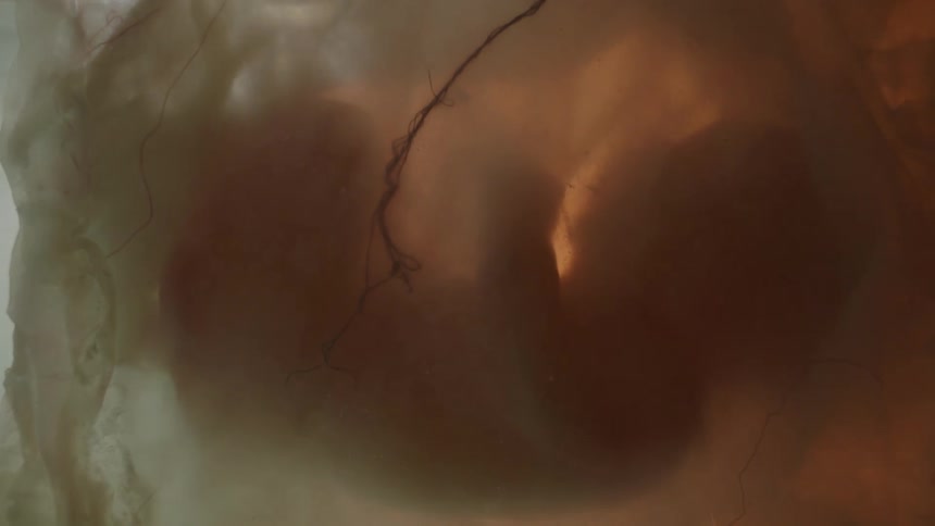 Unborn baby back lit by light floats in gestational sack