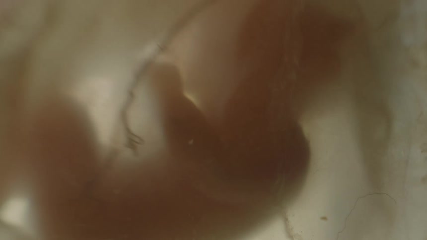 Unborn baby in the wombs