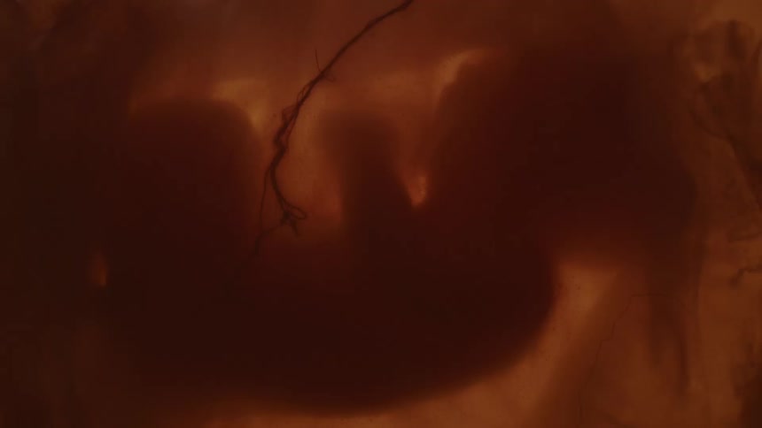 An infant is shown in a mothers uterus