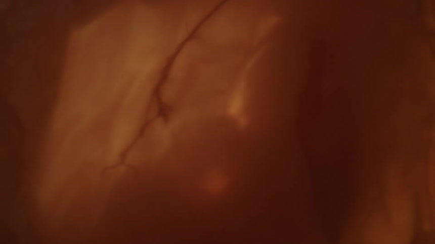 Unborn human baby floating in the amniotic liquid inside the placenta in the womb