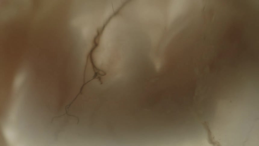 Unborn baby in the womb
