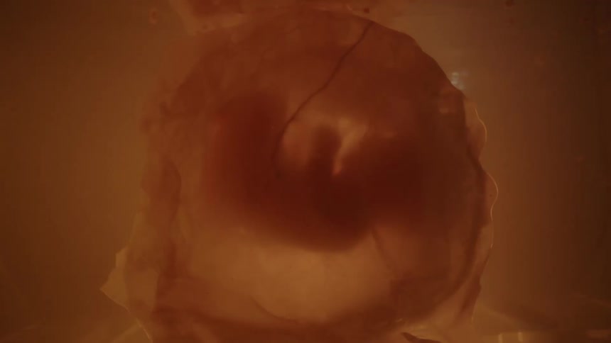 Human unborn fetus floating in amniotic fluid inside the womb