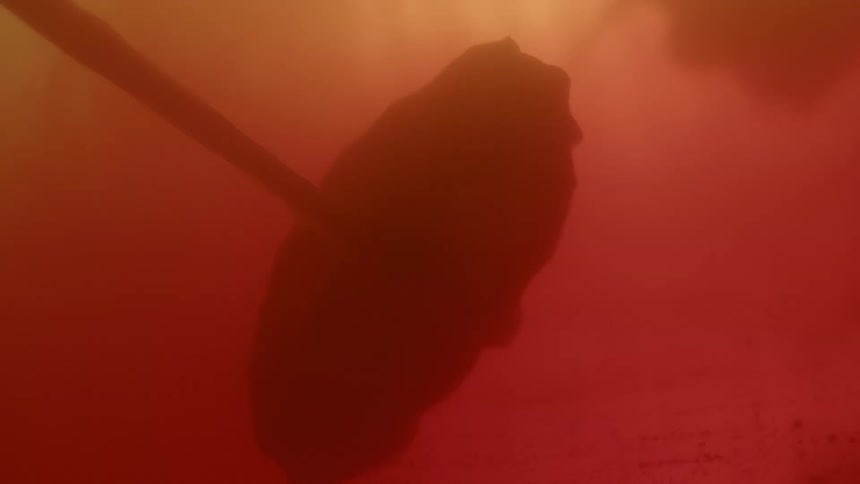 A placenta attached to an umbilical cord floats in fluid