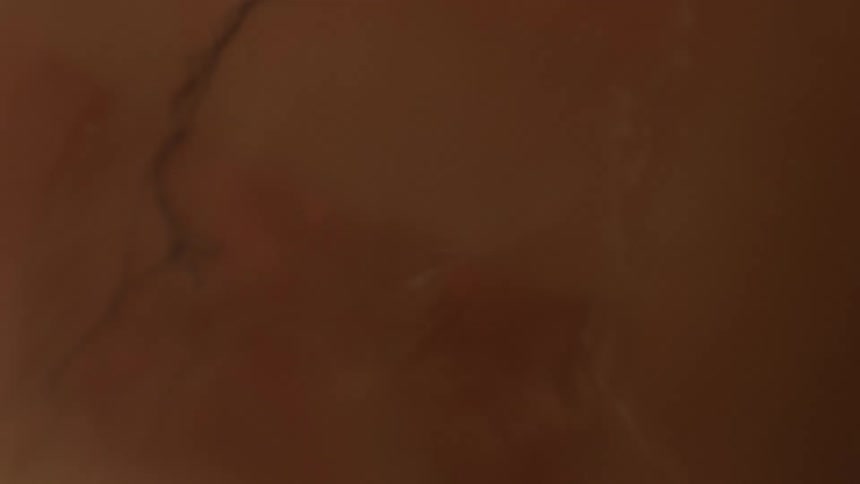 Unborn baby can be seen through gestational sack