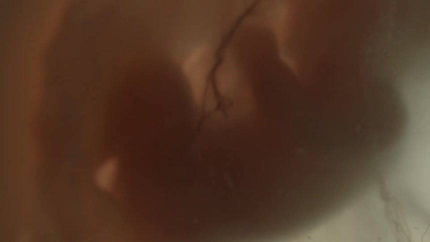 A developing fetus floats inside of a uterus filled with amniotic fluid