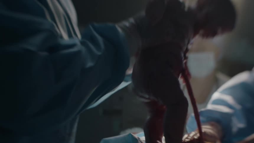 A doctor removes a newborn baby during a cesarean section