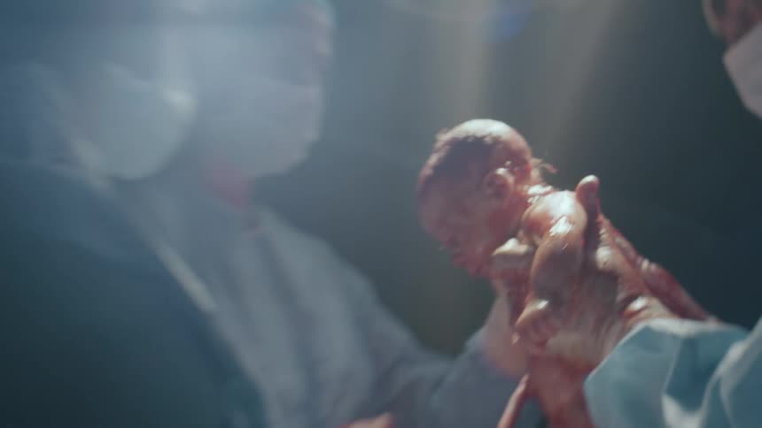 Medical team delivering a baby via c section