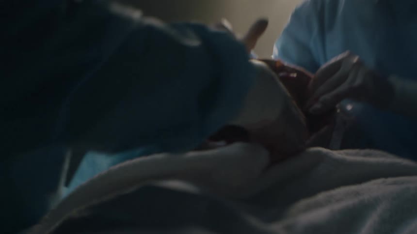 A doctor pulls a newborn baby out during a cesarean section