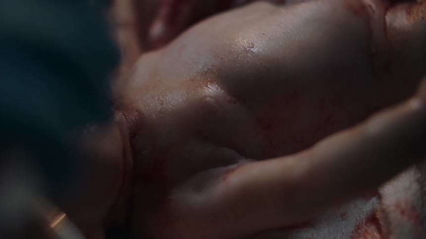 A physician performs chest compression on newborn baby to help it breath