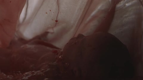 A fetus and liquid in utero