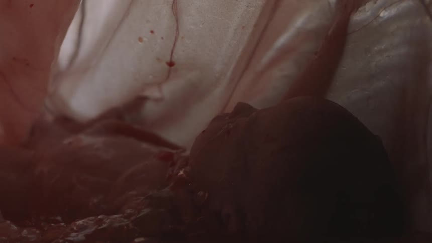 A fetus and liquid in utero