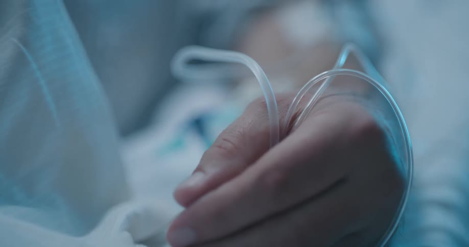 A patient in a hospital bed has numerous intravenous tubes connected to their arm