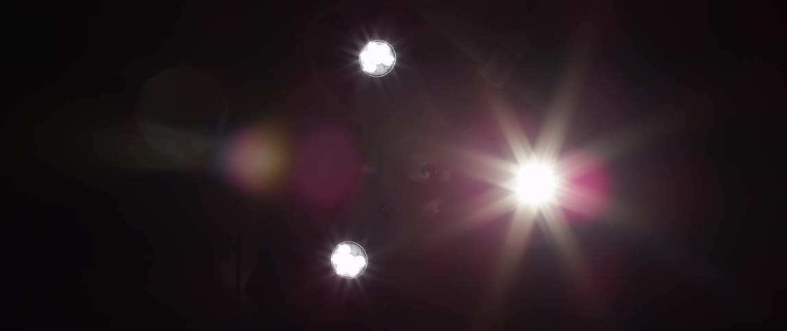 A medical light pans from above
