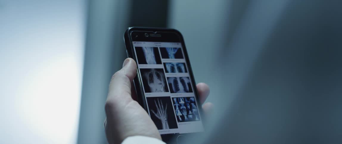 Person looks up images of xrays on smartphone