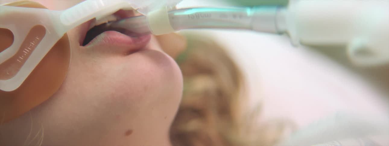 A young woman lays unconscious in a hospital bed with a tube inserted into her mouth