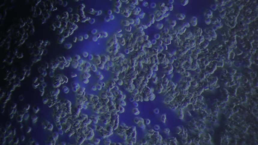 Human blood cells move under a microscope