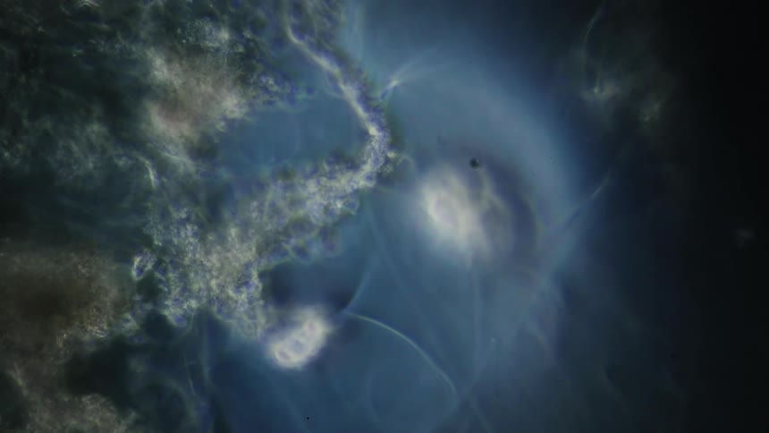 Microscopic view of white gauzy shapes on blue