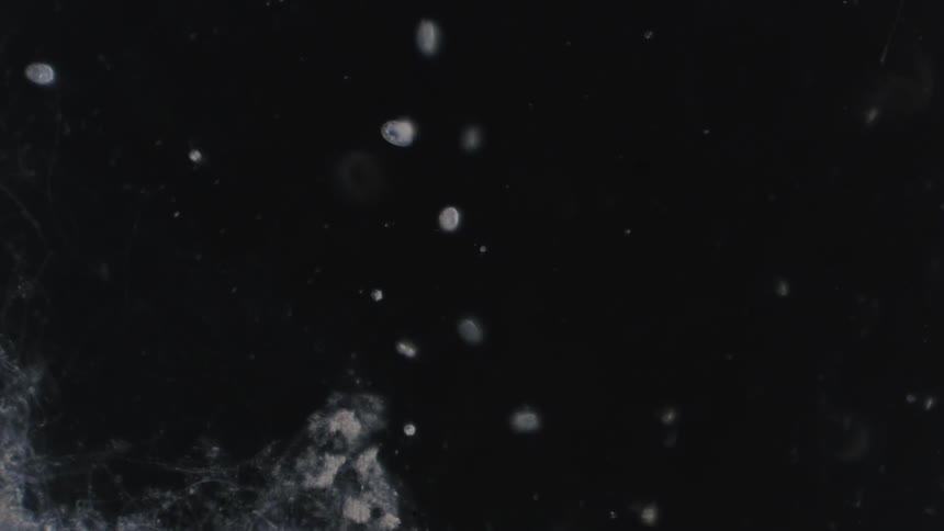Microscopic footage of protozoa and other organisms floating and swiming in water