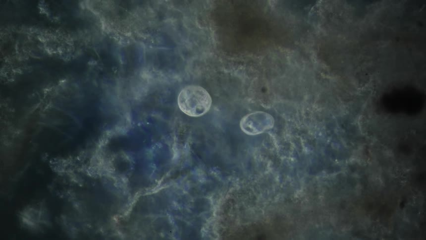 A close up of two microorganisms
